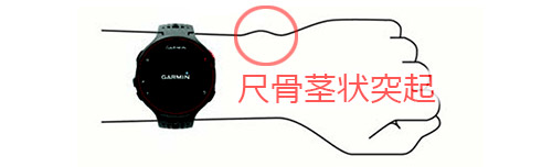 尺骨茎状突起はココ